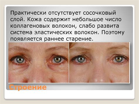 Основные ошибки в уходе за кожей в периорбитальной области и способы их предотвращения