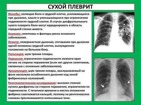 Основные признаки заболевания легких при активной подвижности