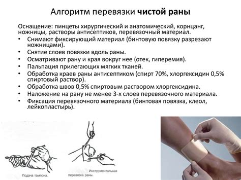 Основные принципы безопасной перевязки раны для предотвращения инфекций