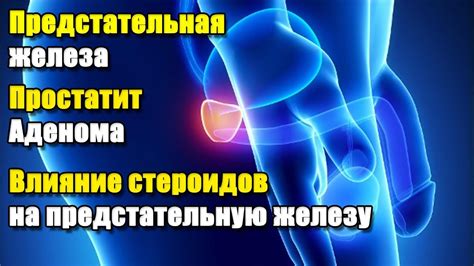 Основные принципы терапевтического воздействия на предстательную железу при ее воспалении