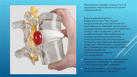Основные принципы физической реабилитации после удаления межпозвоночного диска