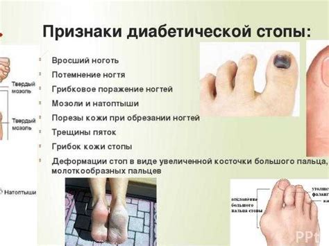 Основные причины гнойничков и вросшего ногтя