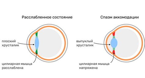 Основные причины и симптомы нарушения аккомодации