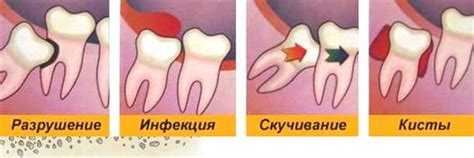 Основные причины отека и боли десен