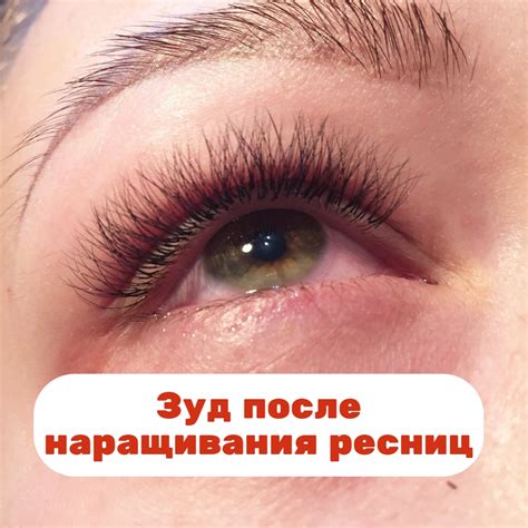 Основные причины слезотечения после наращивания ресниц