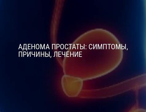 Основные проявления аденомы простаты и причины ее появления