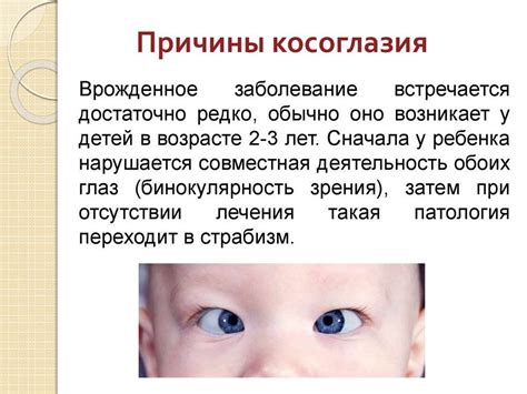 Основные симптомы косоглазия у детей