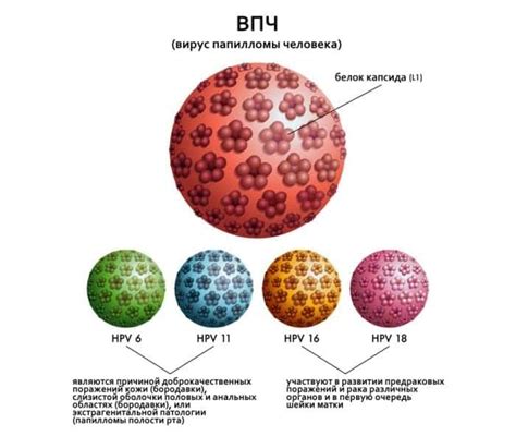 Основные способы диагностики ВПЧ 66 типа у женщин