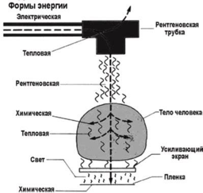 Основы рентгеновской диагностики