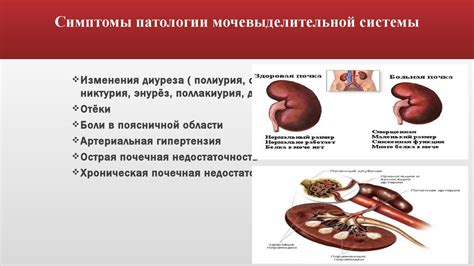 Особенности потребления арбуза при заболеваниях почек