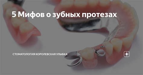 Особыми случаями требуют особого внимания: забота о зубных протезах и имплантатах