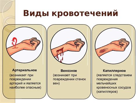 Остановка кровотечения: проверенные приемы и советы