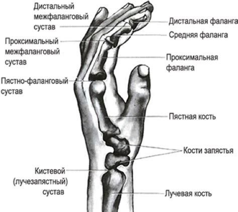 Остеоартроз пальцев руки