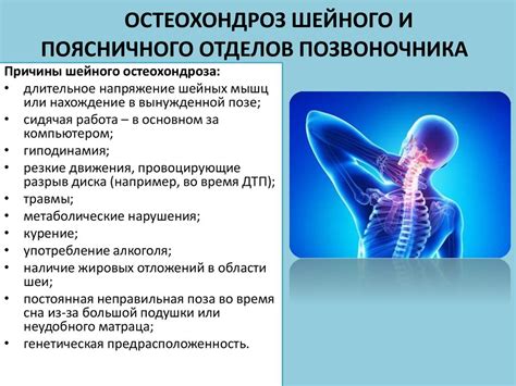 Остеохондроз шейного отдела