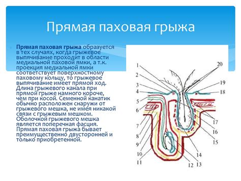 Пальпация паховой области для выявления грыжи