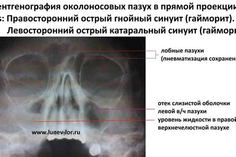 Патологии и заболевания