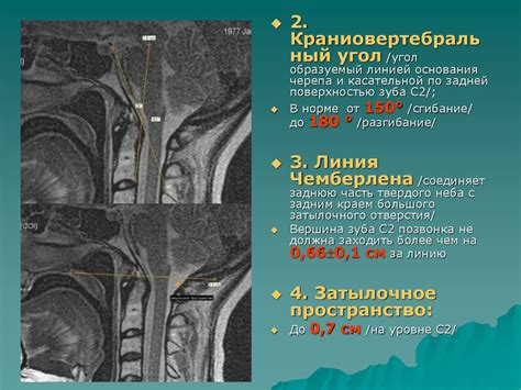 Патологии позвоночника и шейного отдела