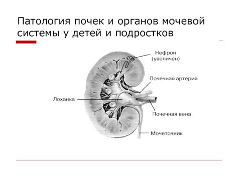 Патология мочевой системы