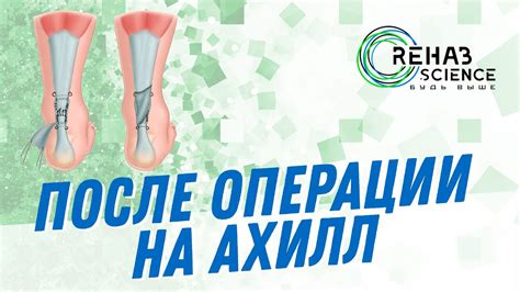 Первые изменения после операции
