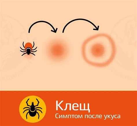 Передача инфекций клещами: что происходит после укуса