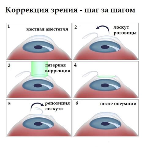 Перспективы прочных результатов и потенциальных осложнений в лазерной коррекции зрения