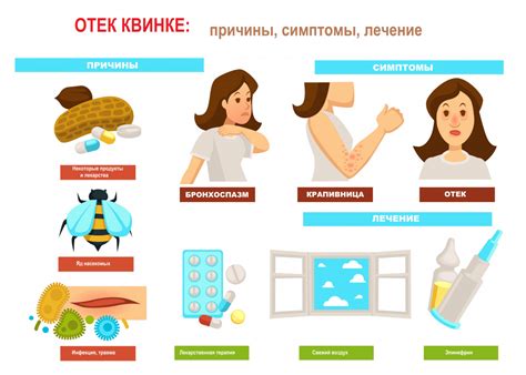 Пить воду при отеке квинке: важные факты