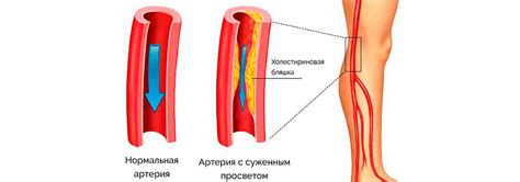Плохое кровообращение и отеки