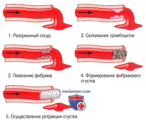 Повреждение сосуда: цвет крови при повреждении