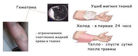 Повреждение сосудов и травма