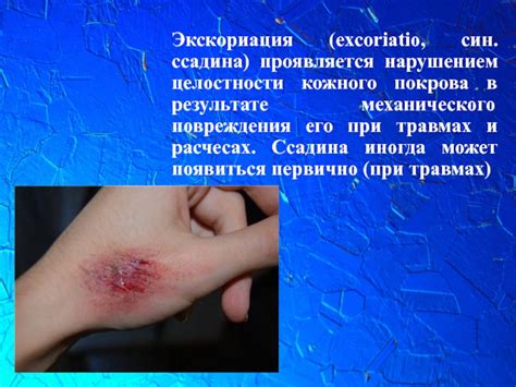 Повреждения кожного покрова