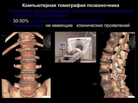 Подготовка к КТ позвоночника