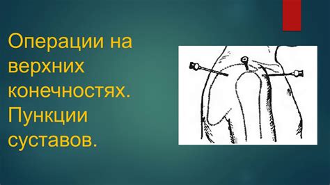 Подготовка к определению пульсации на верхней конечности: полезные рекомендации