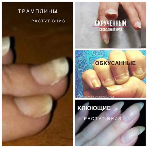 Подробности о росте ногтей