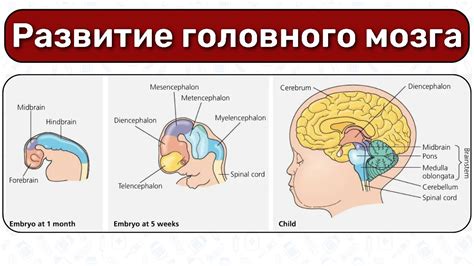 Позитивное воздействие биоакустической терапии на развитие детского мозга