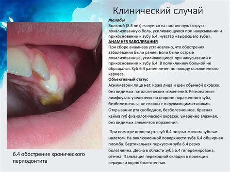 Показания к удалению