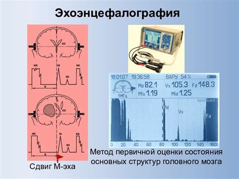 Полезные методы уменьшения эха