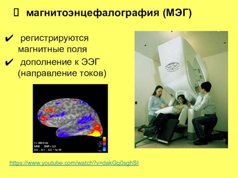 Понятие ээг-направление