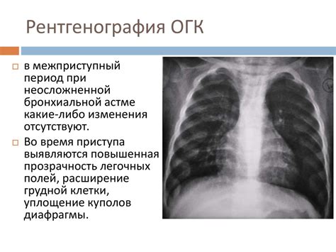 Популярные вопросы и ответы о рентгеновском исследовании при бронхиальной астме