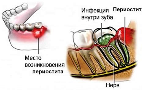 Популярные методы обработки флюса на щеке: