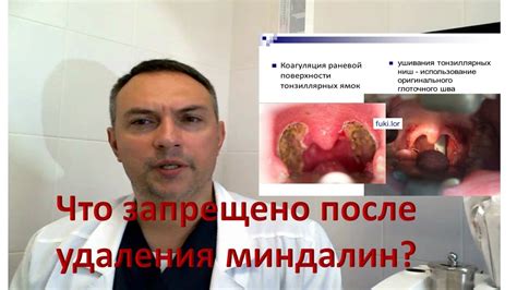 Последующие действия после удаления