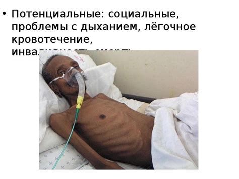 Потенциальные проблемы с дыханием, вызванные расширением аденоидов