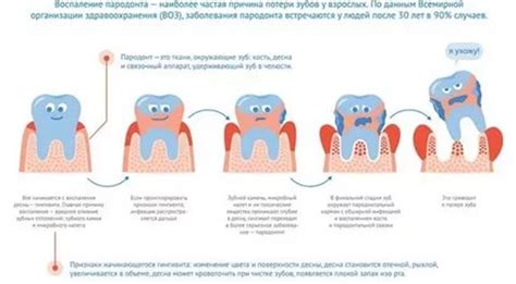 Почему возникает флюс: