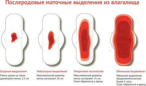 Почему может возникать кровотечение в середине цикла