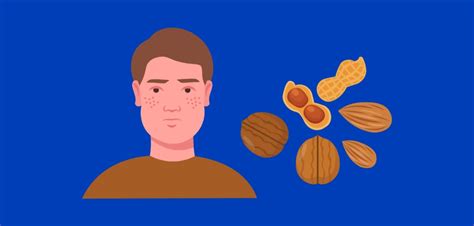 Почему орехи вызывают жжение