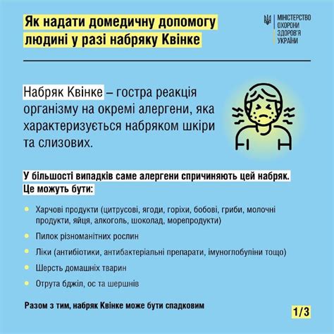 Правила употребления воды при отеке квинке