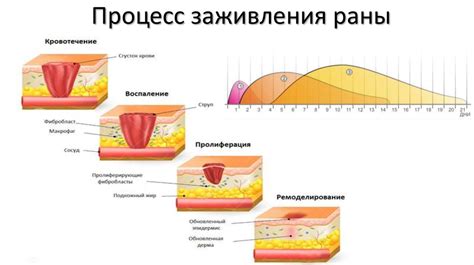 Правильное восстановление и процесс заживления