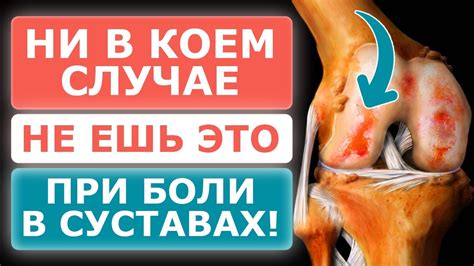 Правильное питание для связок