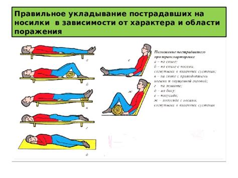 Правильное укладывание