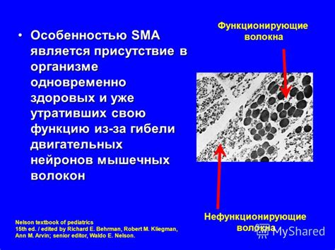 Превращение утративших свою функцию предметов в полезные аксессуары