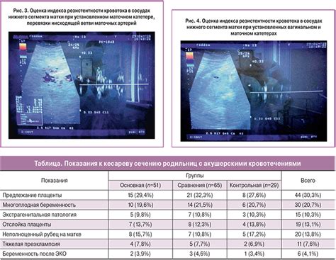 Преимущества вагинального способа применения